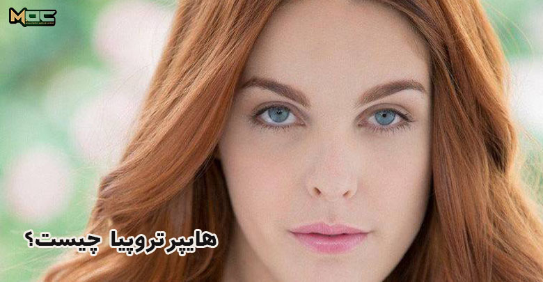 هایپرتروپیا چیست