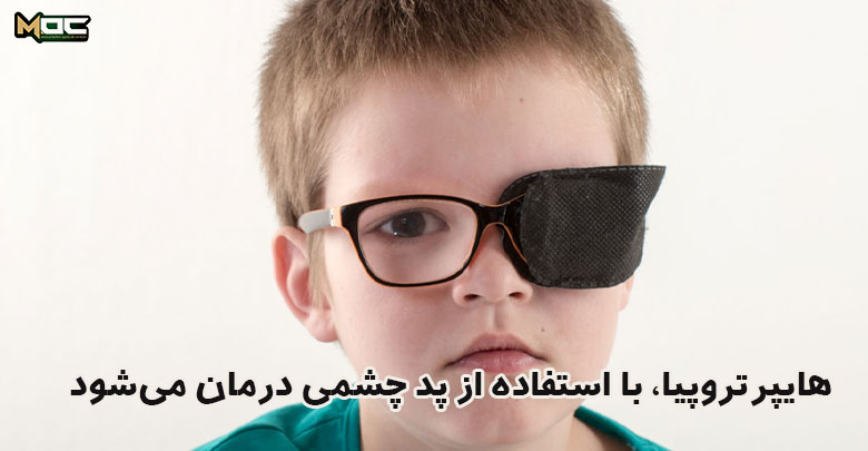 پد چشمی و هایپرتروپیا