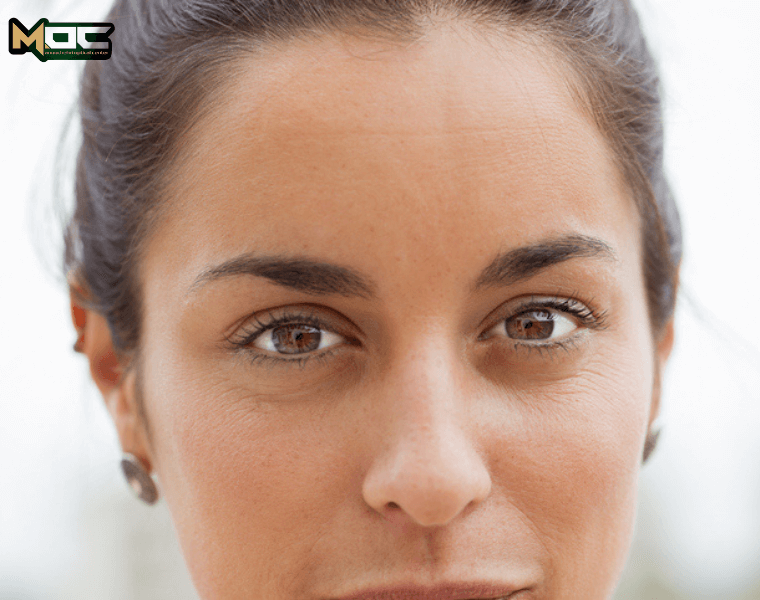 قوز قرنیه و مشکلات آن