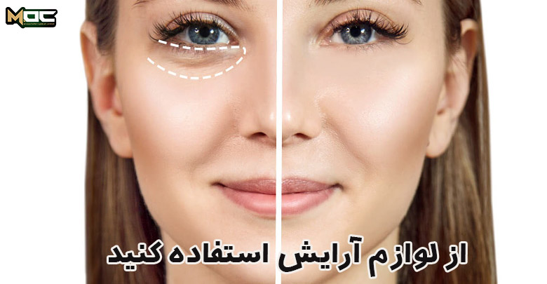 با آرایش تیرگی دور چشم را رفع کنید