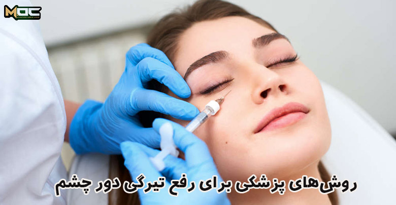 درمان های پزشکی تیرگی زیر چشم