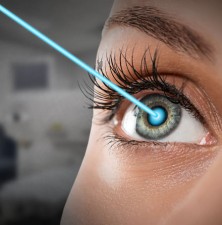 جراحی چشم لازک چیست؟